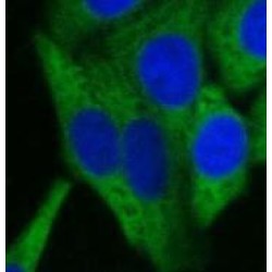 Vacuolar Protein Sorting-Associated Protein 24 (VPS24) Antibody