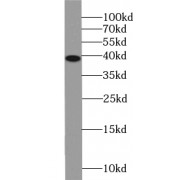 WB analysis of human brain tissue, using VPS26B antibody (1/1000 dilution).