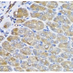 Vacuolar Protein Sorting-Associated Protein 37A (VPS37A) Antibody