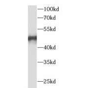 WB analysis of human liver tissue, using VPS37A antibody (1/1000 dilution).