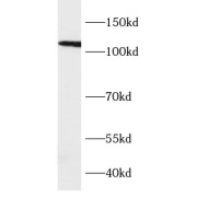 WB analysis of A549 cells, using VPS39 antibody (1/1000 dilution).