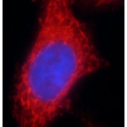 Vacuolar Protein Sorting-Associated Protein 45 (VPS45) Antibody