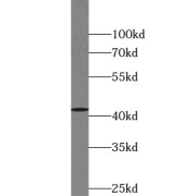 WB analysis of mouse eye tissue, using VSX2 antibody (1/600 dilution).