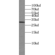 WB analysis of human brain tissue, using VTI1A antibody (1/500 dilution).