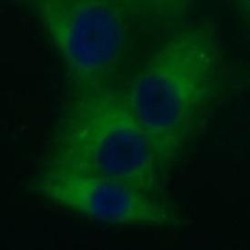 Von Willebrand Factor A Domain Containing Protein 2 (VWA2) Antibody