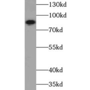 WB analysis of A375 cells, using VWA2 antibody (1/600 dilution).