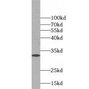 WB analysis of mouse brain tissue, using WBP2 antibody (1/1000 dilution).