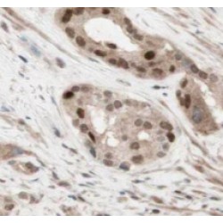 WBS15/LAT2 (LAT2) Antibody