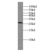 WB analysis of mouse brain tissue, using LAT2 antibody (1/1000 dilution).