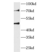 WB analysis of Rat liver tissue, using WBSCR16 antibody (1/600 dilution).