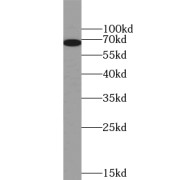 WB analysis of mouse lung tissue, using WBSCR17 antibody (1/500 dilution).