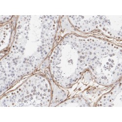 WD Repeat-Containing Protein 1 (WDR1) Antibody