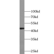 WB analysis of Jurkat cells, using WDR18 antibody (1/500 dilution).