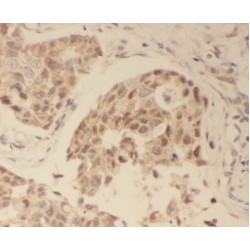 WD Repeat-Containing Protein 61 (WDR61) Antibody