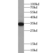 WB analysis of mouse liver tissue, using WDR61 antibody (1/1000 dilution).