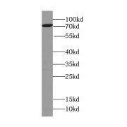 WB analysis of Recombinant proteins, using Willin antibody (1/1000 dilution).