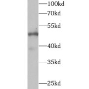 WB analysis of human placenta tissue, using WIPI2 antibody (1/1000 dilution).