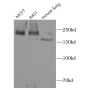 WB analysis of (1) MCF-7 cells, (2) A431 cells, and (3) mouse lung tissue, using WRN antibody (1/300 dilution).