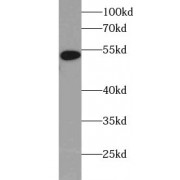 WB analysis of Jurkat cells, using WTAP antibody (1/1000 dilution).