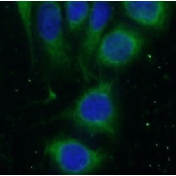 NEDD4-Like E3 Ubiquitin-Protein Ligase WWP1 (WWP1) Antibody