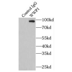 NEDD4-Like E3 Ubiquitin-Protein Ligase WWP1 (WWP1) Antibody