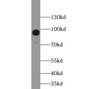 WB analysis of PC-3 cells, using WWP1 antibody (1/300 dilution).