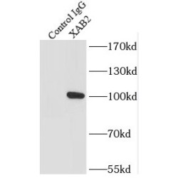 Pre-mRNA-Splicing Factor SYF1 (XAB2) Antibody