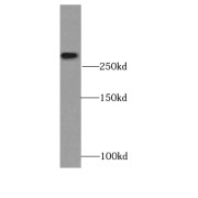 WB analysis of COLO 320 cells, using XIRP2 antibody (1/500 dilution).