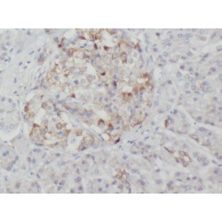 X-Linked Kx Blood Group (McLeod Syndrome) (XK) Antibody