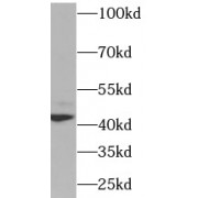 WB analysis of K-562 cells, using XRCC4 antibody (1/1000 dilution).
