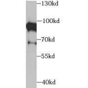 WB analysis of HepG2 cells, using XRCC5 antibody (1/1000 dilution).