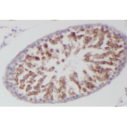 Tyrosine-tRNA Ligase, Mitochondrial (YARS2) Antibody