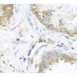 Nuclease-Sensitive Element-Binding Protein 1 (YBX1) Antibody