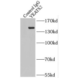 YEATS Domain Containing 2 (YEATS2) Antibody