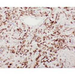 Protein YIPF4 (YIPF4) Antibody