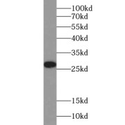 WB analysis of Jurkat cells, using YIPF4 antibody (1/500 dilution).