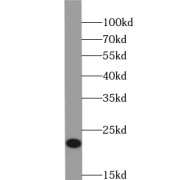 WB analysis of human brain tissue, using YPEL1 antibody (1/400 dilution).