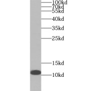 WB analysis of BxPC-3 cells, using YPEL3 antibody (1/1000 dilution).