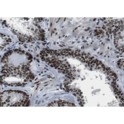 Protein Yippee-Like 5 (YPEL5) Antibody