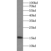 WB analysis of mouse brain tissue, using YPEL5 antibody (1/500 dilution).