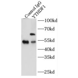 YTH Domain Family Protein 1 (YTHDF1) Antibody