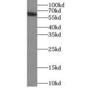 WB analysis of HeLa cells, using YTHDF1 antibody (1/500 dilution).