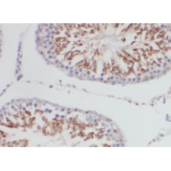 YTH Domain Family Protein 2 (YTHDF2) Antibody