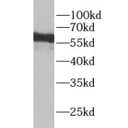 WB analysis of HepG2 cells, using YTHDF3 antibody (1/1000 dilution).