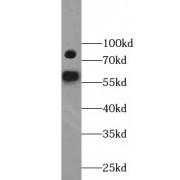 WB analysis of MDA-MB-231 cells, using YY1AP1 antibody (1/800 dilution).