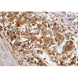 Z-DNA-Binding Protein 1 (ZBP1) Antibody