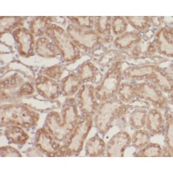 Zinc Finger And BTB Domain-Containing Protein 20 (ZBTB20) Antibody