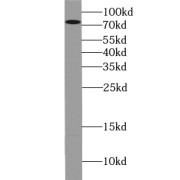 WB analysis of L02 cells, using ZBTB20 antibody (1/1000 dilution).