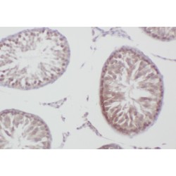 Zinc Finger And BTB Domain-Containing Protein 38 (ZBTB38) Antibody