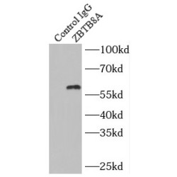 Zinc Finger And BTB Domain-Containing Protein 8A (ZBTB8A) Antibody